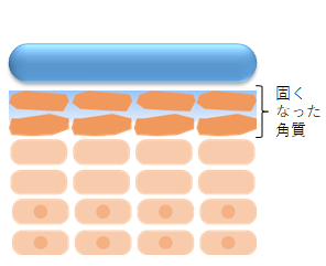 新しいメディプラスゲルは固くなった肌をほぐします。